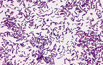 Corynebacterium diphtheriae