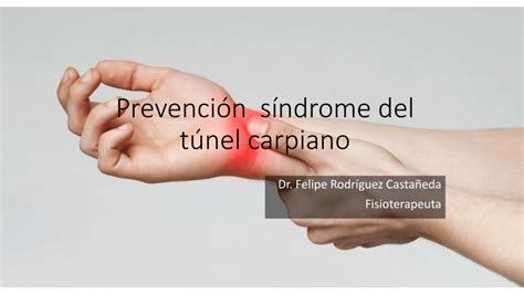 (PDF) Prevención síndrome del túnel carpiano