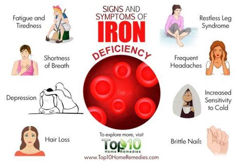 10 Signs and Symptoms of Iron Deficiency | Top 10 Home Remedies