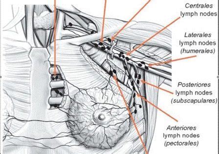 Lymph Nodes Chest – PIP ACTION CAMPAIGN