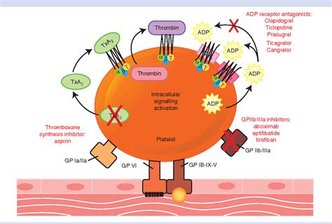 Figure 1 from Perioperative management of antiplatelet therapy ...