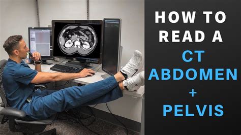 Radiology: How to Read a CT Abdomen & Pelvis (My search pattern) - YouTube