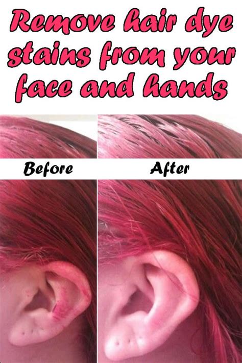 Useful Ideas On How To Remove Hair Dye From Skin - AllDayChic