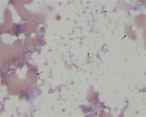 Urinalysis Archives | eClinpath