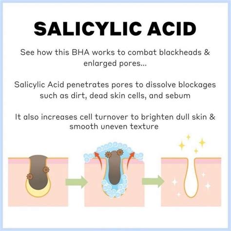 Salicylic acid | Salicylic acid, Skin care business, Basic skin care routine