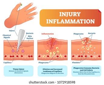 195,331 Wound Images, Stock Photos & Vectors | Shutterstock