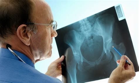 Total Hip Replacement Surgery | The Process | Proliance Orthopedic