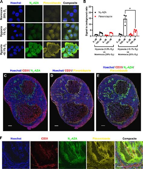 Pimonidazole immunostaining is comparable to that of N 3 -AZA. (A ...