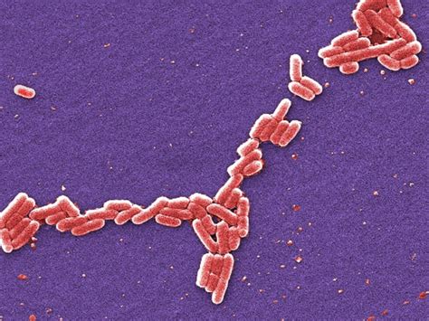 What to know about E. coli after the romaine lettuce-related outbreak ...