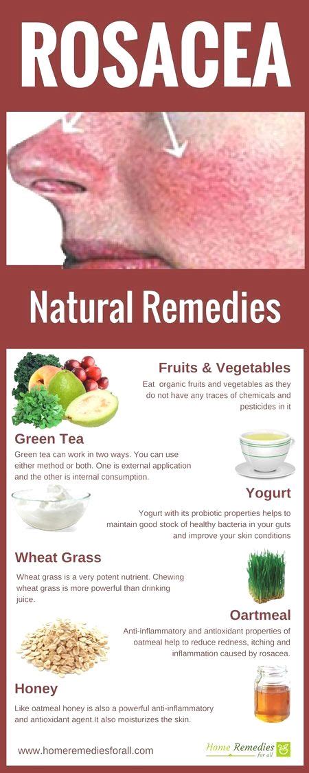 rosacea home #remedies infographic #natural care | Natural remedies for rosacea, Acne remedies ...