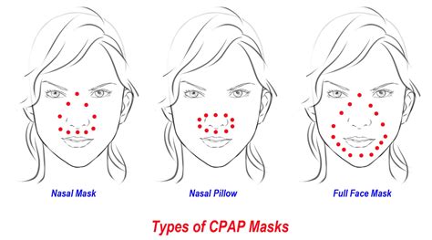 Types of CPAP Masks for Sleep Apnea Treatment