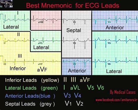 12 EKG Leads | พยาบาล, นักเรียนพยาบาล, การแพทย์