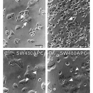 SW480APC cells migrate differently to SW480 cells in a wound assay ...