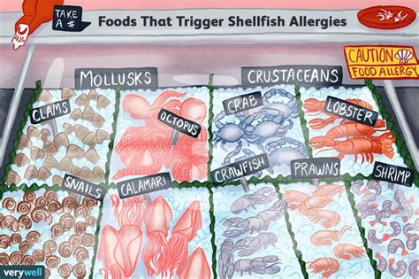 Pin by Courtney Thrower on Health | Shellfish allergy, Shellfish, Allergies