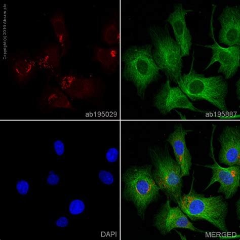 Alexa Fluor® 647 Anti-Von Willebrand Factor antibody [EPSISR15] (ab195029)