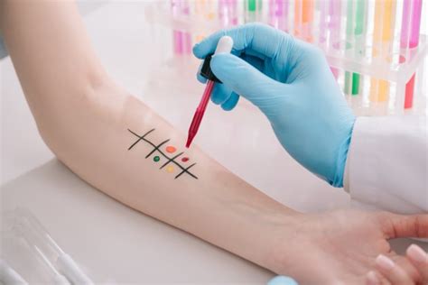 Allergy Skin Test: Everything You Need to Know | Dr. Amy Schiffman, MD