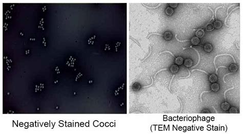 Cell Membrane in Bacteria