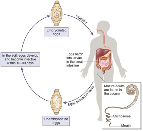 Life Cycle Of Trichuris Trichiura | Images and Photos finder