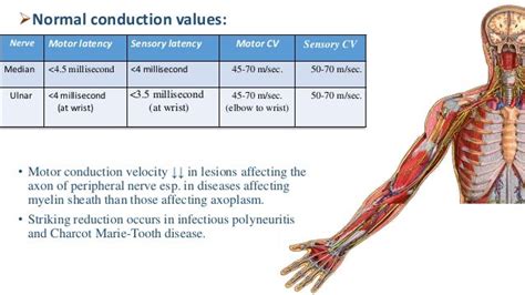 Abnormal Nerve Conduction Test Results