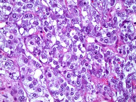 Adrenal Gland Cortex And Medulla at Chris Hagan blog