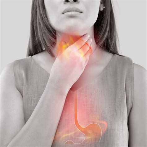 GASTROESOPHAGEAL REFLUX DISEASE (GERD) - Symptoms, Causes, Natural Home Remedies and Reflux Diet ...