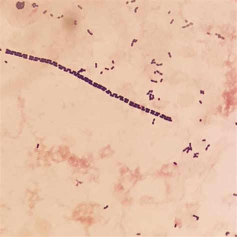 Microscopy (gram stain) of Streptococcus mitis - shaped like a zipper ...