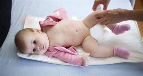 Loose motions in babies might not always suggest diarrhoea - Read ...