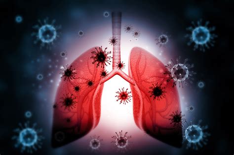 Algorithm Reduces Antibiotic Use in Lower Respiratory Tract Infection - The Clinical Advisor