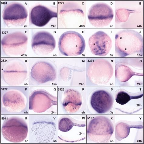 A Gene Expression Screen in Zebrafish Embryogenesis