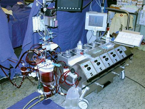 Heart–lung machine | medical device | Britannica