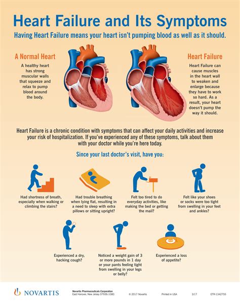 "HF Symptoms" In-Office Poster - noahgaynin.com