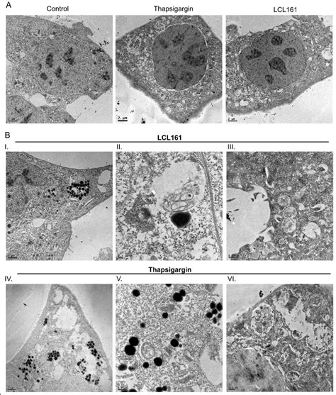 Lysosome Electron Micrograph