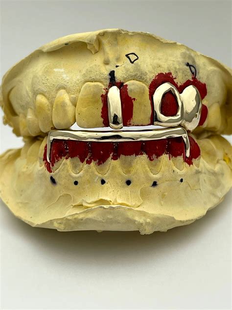 Gold Teeth/Grills – Popular J