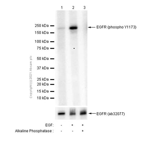 Recombinant Anti-EGFR (phospho Y1173) antibody [E124] - BSA and Azide free (ab203559)