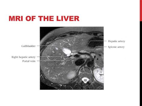 PPT - Imaging Anatomy of the Liver PowerPoint Presentation, free download - ID:1932425