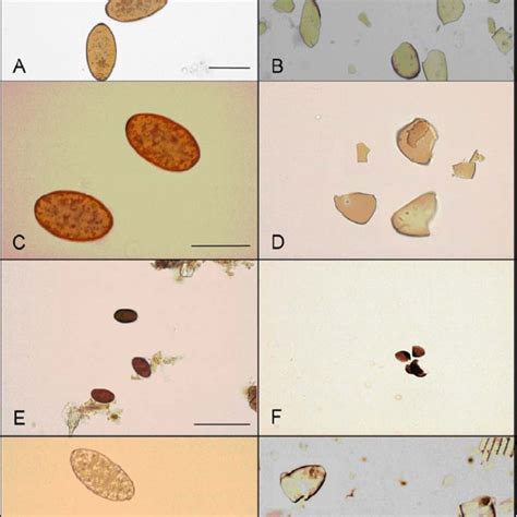 Eggs of Fasciola hepatica (A, B), Fascioloides magna (C, D),... | Download Scientific Diagram