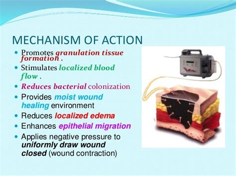 VACUUM ASSISTED WOUND THERAPY