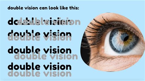 Double Vision - EXPLAINED! | Dr. D'Orio Eyecare - YouTube