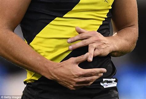 AFL star suffers horrific dislocated finger during game | Daily Mail Online