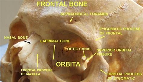 Superior Orbital Fissure Sphenoid Bone