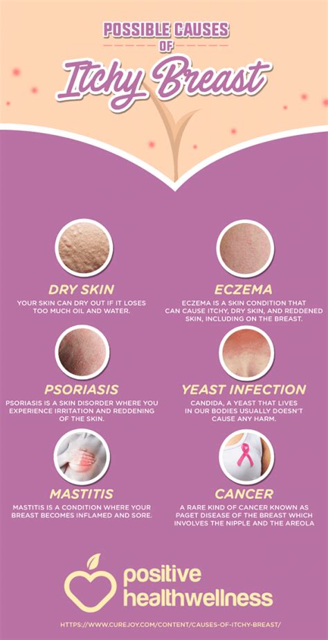 6 Possible Causes Of Itchy Breasts – Infographic – Positive Health Wellness