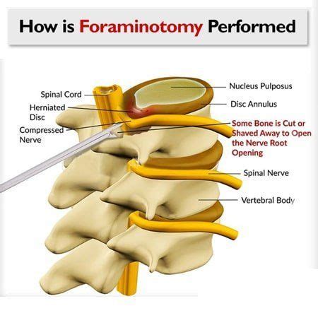 Pin on Physio