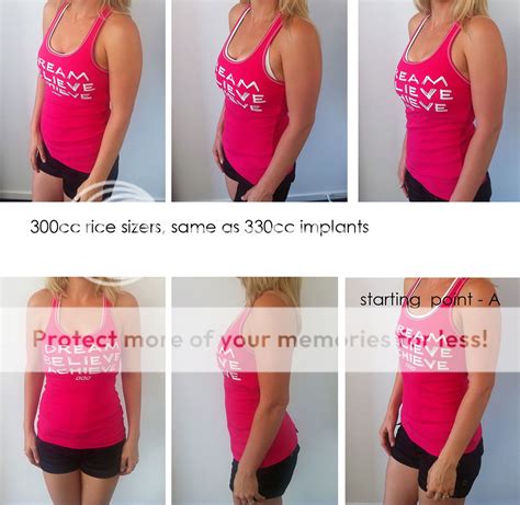 Opinion on 300cc Rice sizers (pics included) - Just Breast Implants Forum