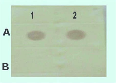 Dot-blot hybridization assay showing the colored spots of hybridized ...