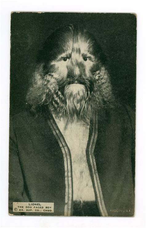 Stephan Bibrowski: Lionel the Lion-Faced Man. (1891–1932) | Dog face ...