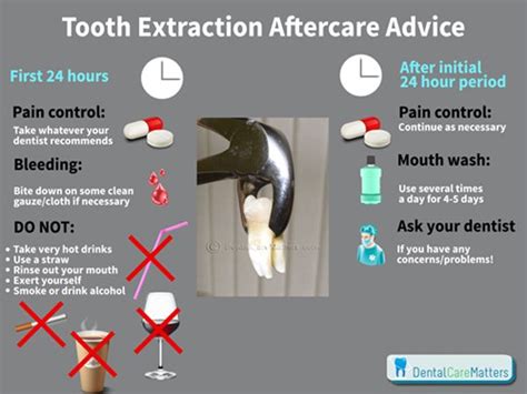 Pin on Dental Treatments Explained