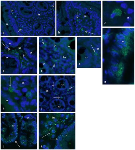 a–c) CD45 antibody detected positive CD45 cells in the lamina propria ...