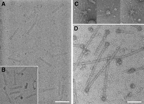 Cryo-electron microscopy of Afp and negative stain microscopy of TBC. A... | Download Scientific ...