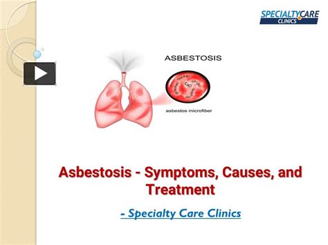 PPT – Asbestosis - Symptoms, Causes, and Treatment PowerPoint presentation | free to download ...