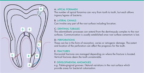 Figure 2 from Perio-Endo Lesions: A Guide to Diagnosis and Clinical Management | Semantic Scholar